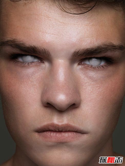 十大世界上最稀有的瞳孔色：你見(jiàn)過(guò)銀色、粉色瞳孔嗎？