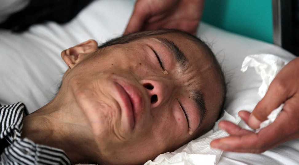 十大最痛苦癌癥排行：第九與吃有關(guān),第一個(gè)男性最怕