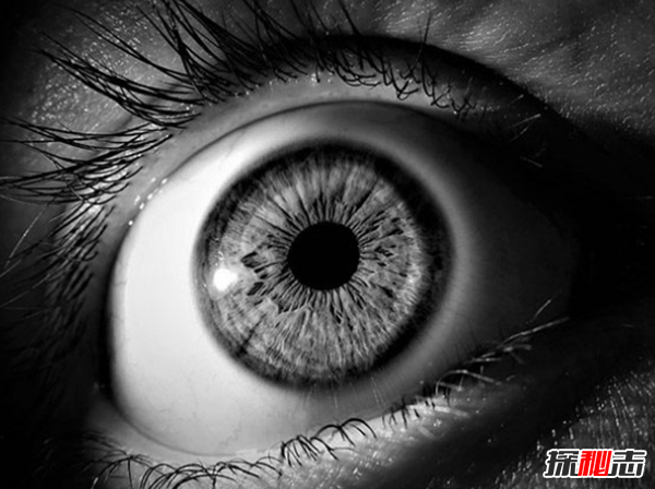 十個(gè)恐怖的真實(shí)醫學(xué)故事,你能堅持看完嗎?(令人不安