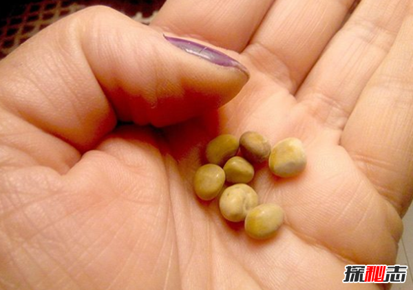 十個(gè)恐怖的真實(shí)醫學(xué)故事,你能堅持看完嗎?(令人不安