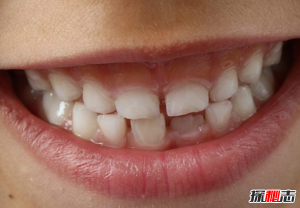 十個(gè)恐怖的真實(shí)醫學(xué)故事,你能堅持看完嗎?(令人不安