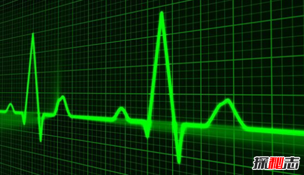 十個(gè)恐怖的真實(shí)醫學(xué)故事,你能堅持看完嗎?(令人不安