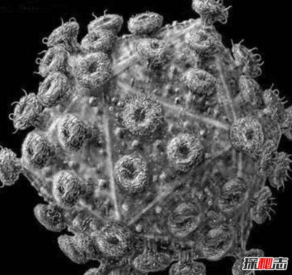 史上死亡人數最多的流行?。喝澜缃?億人喪生(慘不忍睹)