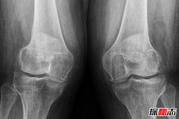 史上最不可思議的十大恐懼癥 沒(méi)有人能接受的了(震驚)