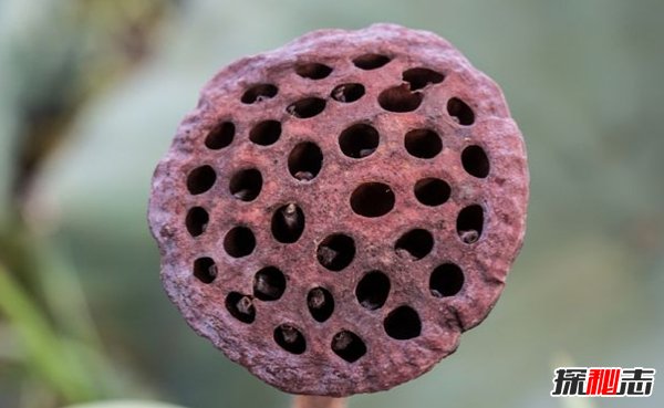 史上最不可思議的十大恐懼癥 沒(méi)有人能接受的了(震驚)