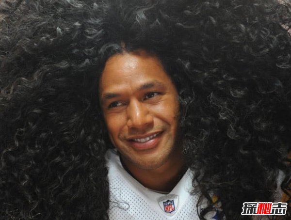 史上最不可思議的十大恐懼癥 沒(méi)有人能接受的了(震驚)