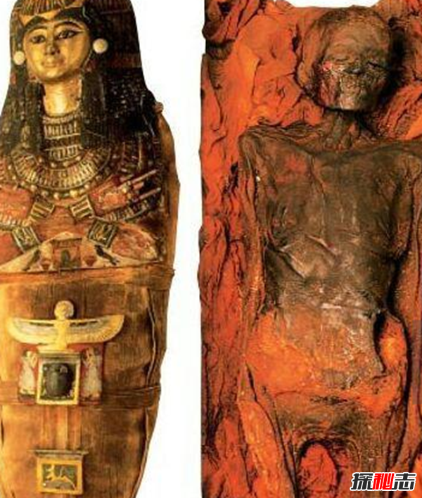 世界上科學(xué)解釋不了的事,印尼女子一夜長(cháng)出10公分鐵絲