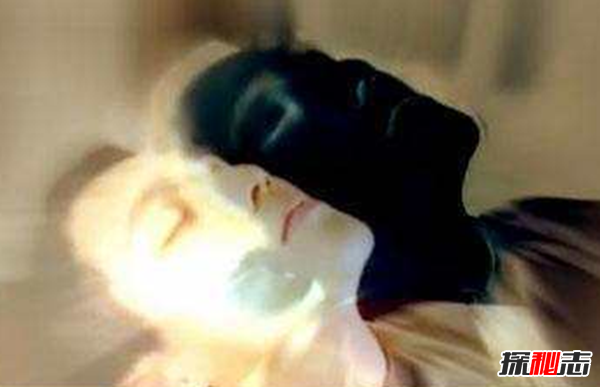 世界上科學(xué)解釋不了的事,印尼女子一夜長(cháng)出10公分鐵絲