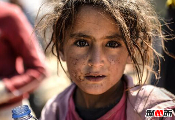 世界上收容難民最多的國家 98%敘利亞難民都在這個(gè)國家?