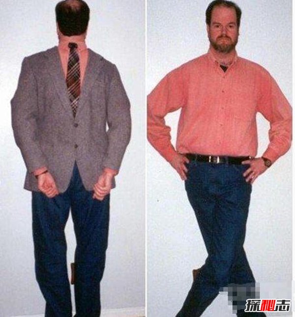 世界上已公開(kāi)的異能者,透視眼少女能射穿墻壁