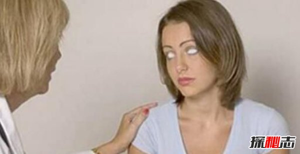 世界上已公開(kāi)的異能者,透視眼少女能射穿墻壁