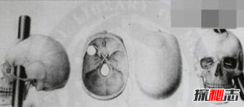 世界上有長(cháng)生不死的人嗎?亞馬遜原始森林死不了的人奧魯·烏加歐