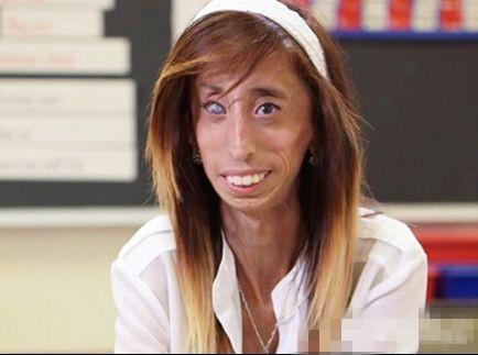 世界上最丑的女人 膽小者勿入