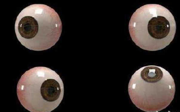 世界首個(gè)3D人工眼球問(wèn)世，數百萬(wàn)人將重見(jiàn)光明