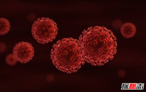 艾滋病真的好恐怖?預防艾滋10條基本知識