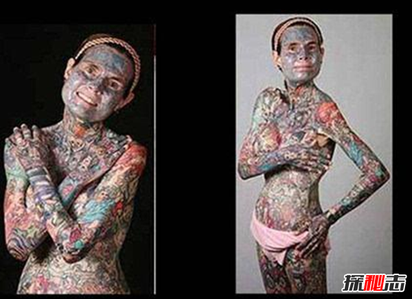 卟啉病為什么要喝血?卟啉病真實(shí)患者圖片(吸血鬼的原型病)