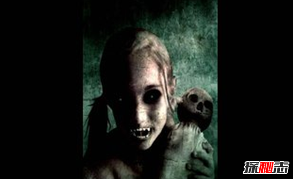 卟啉病為什么要喝血?卟啉病真實(shí)患者圖片(吸血鬼的原型病)