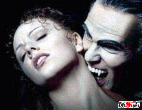 卟啉病為什么要喝血?卟啉病真實(shí)患者圖片(吸血鬼的原型病)