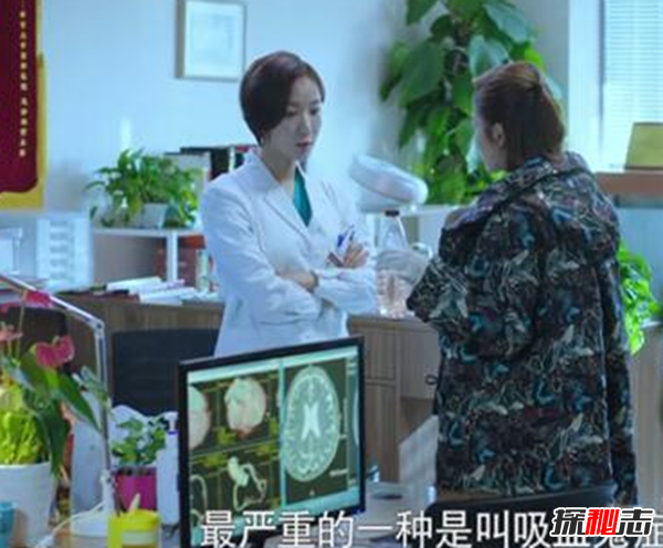 卟啉病為什么要喝血?卟啉病真實(shí)患者圖片(吸血鬼的原型病)