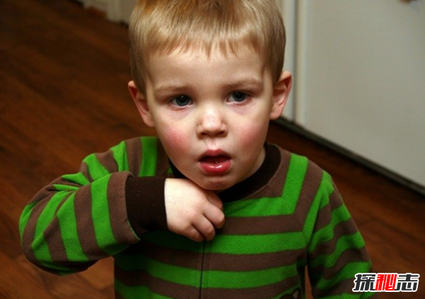 蜂蜜有哪些功效和作用?關(guān)于蜂蜜的十大用途