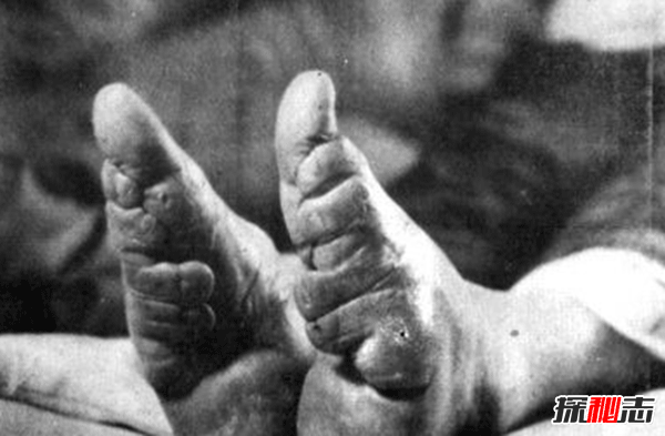 古人裹腳是為什么?三寸金蓮腳的10個(gè)奇怪事實(shí)