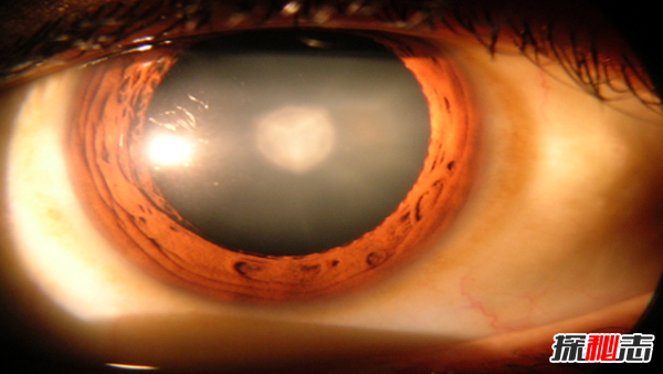 關(guān)于眼睛的12個(gè)瘋狂事實(shí),每只眼睛都含有1.07億個(gè)細胞