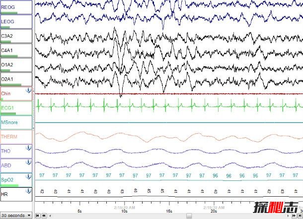 鬼壓床是睡眠癱瘓?科學(xué)解釋恐怖的睡眠癱瘓